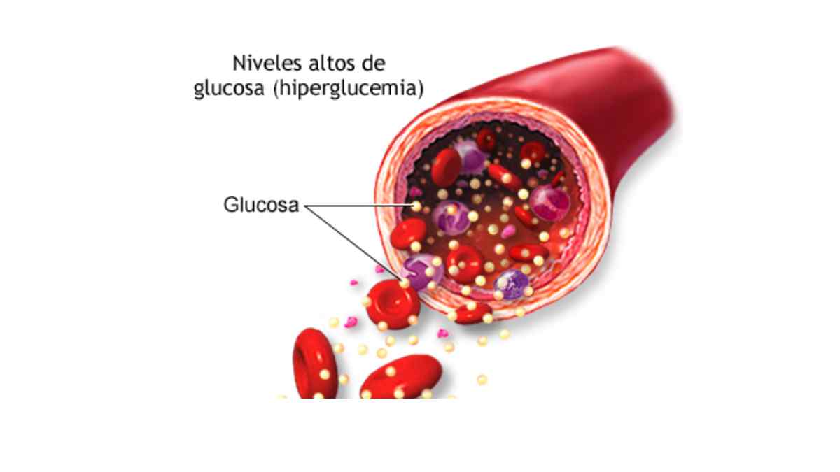 Hay investigaciones sobre los efectos de la canela en la glucosa.