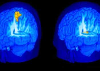 La ciencia ha demostrado los beneficios de la meditación en nuestro cerebro.