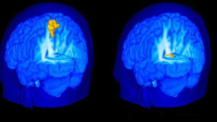 La ciencia ha demostrado los beneficios de la meditación en nuestro cerebro.