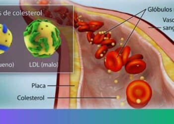 Profesionales desmienten algunos mitos sobre el colesterol.