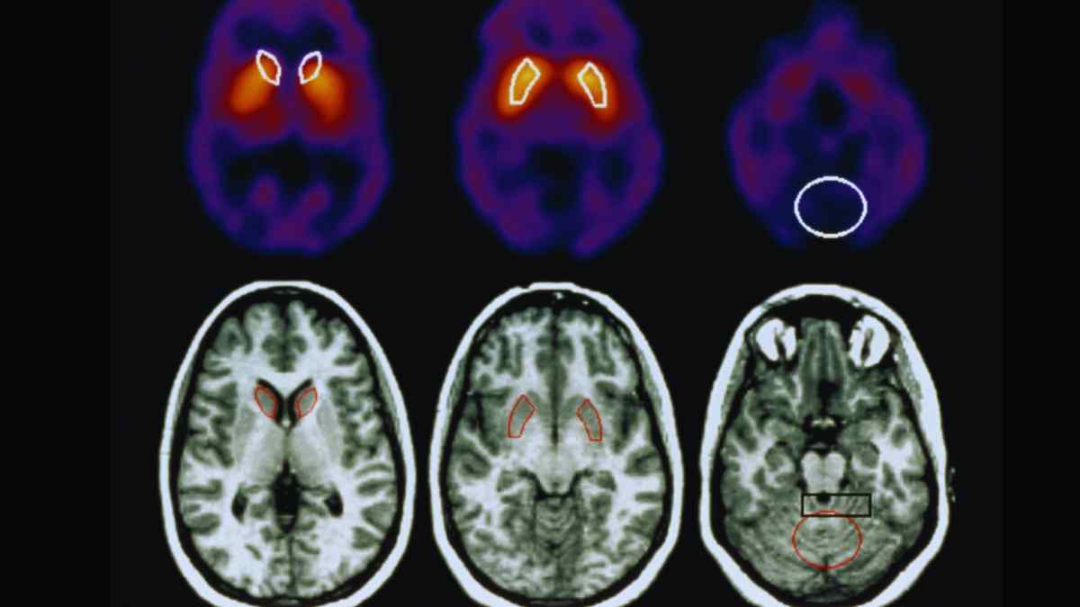 Neurólogos advierten de los peligros del abuso de las redes sociales