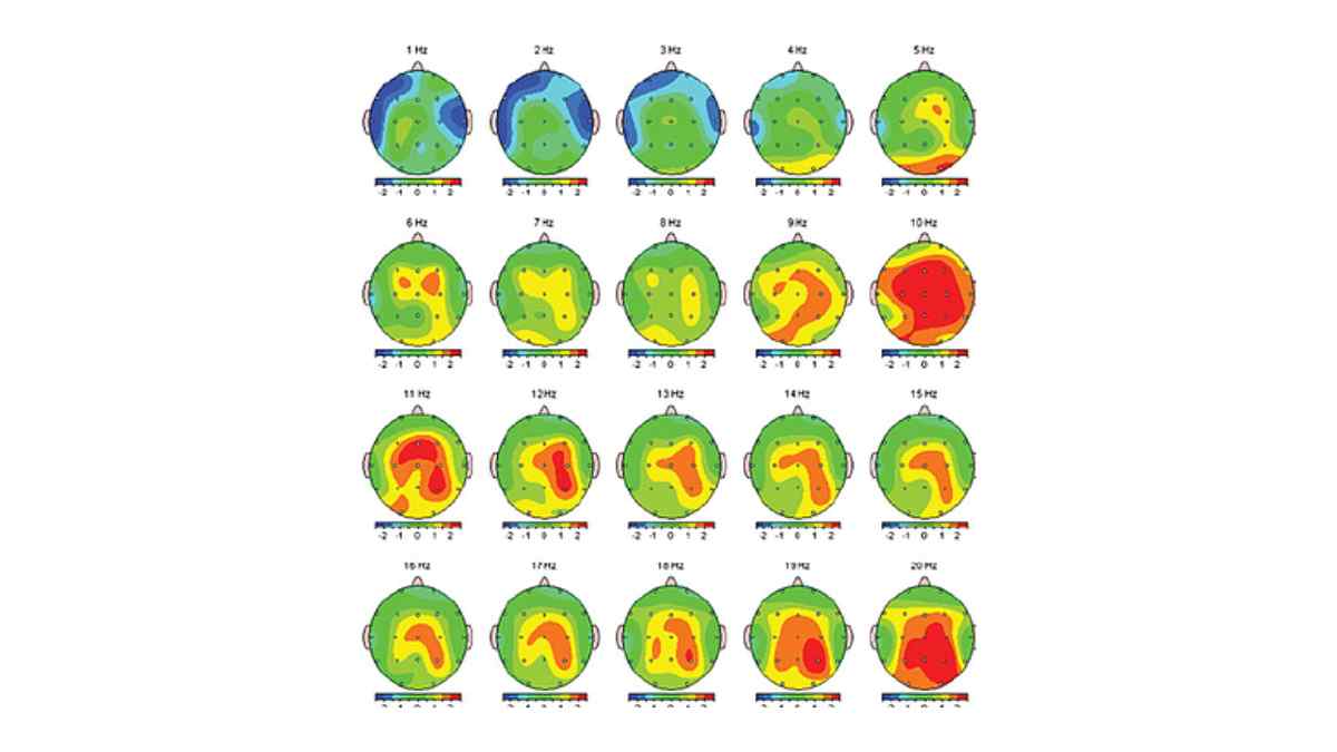 En neurofeedback, entrenamiento cerebral aue aumenta la atención y disminuye la ansiedad.