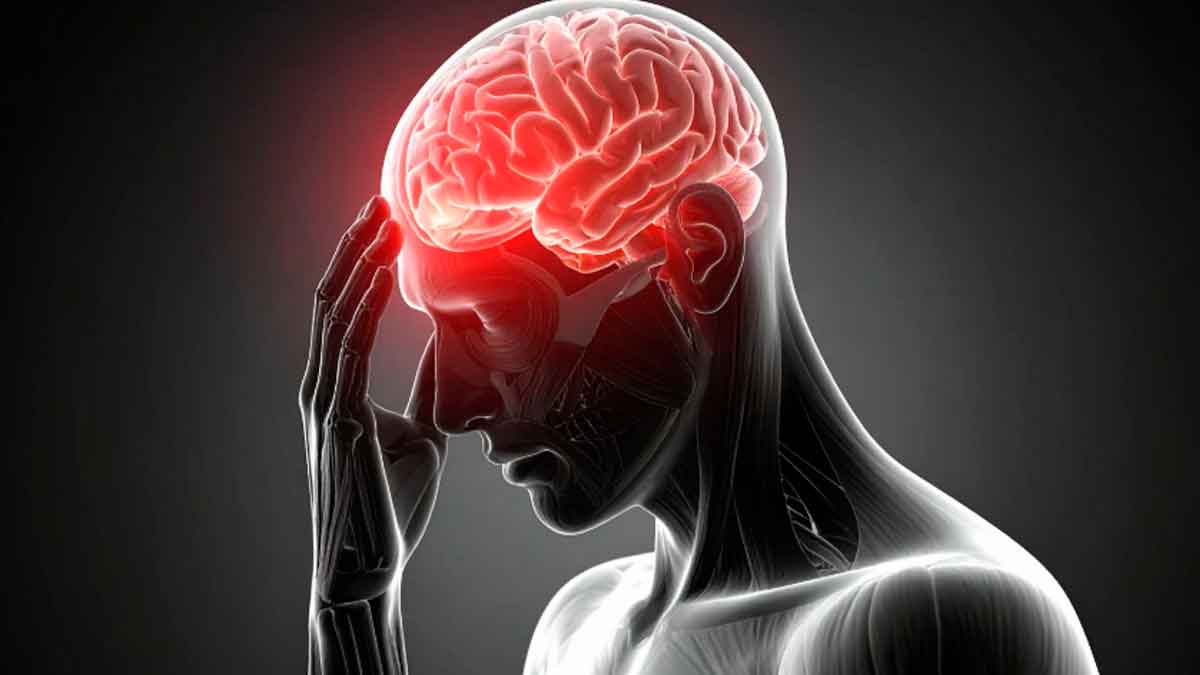 Ilustración de un cerebro humano con dolor intenso representando un ictus o accidente cerebrovascular
